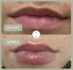 Capture d’écran 2026-02-13 à 15.05.37