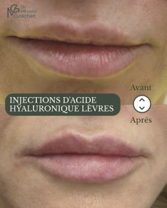 Capture d’écran 2026-02-13 à 15.06.24