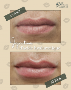 Capture d’écran 2026-02-13 à 15.06.35