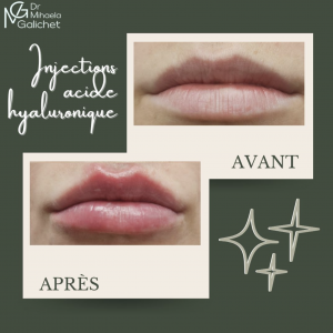 Capture d’écran 2026-02-13 à 15.07.56