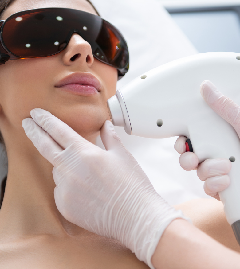 épilation laser visage