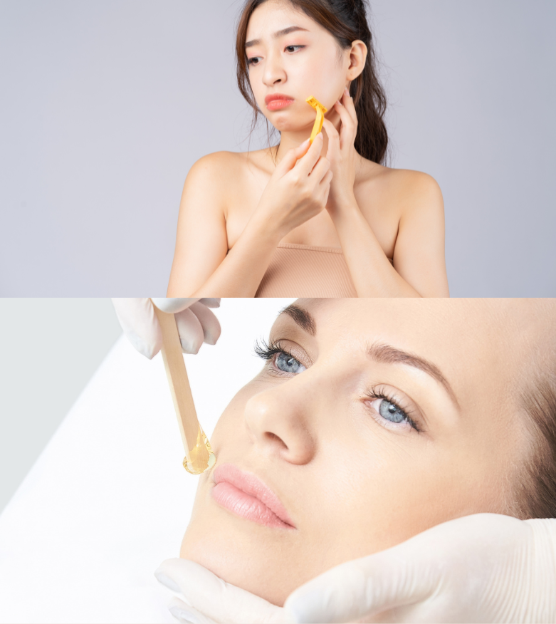 épilation visage