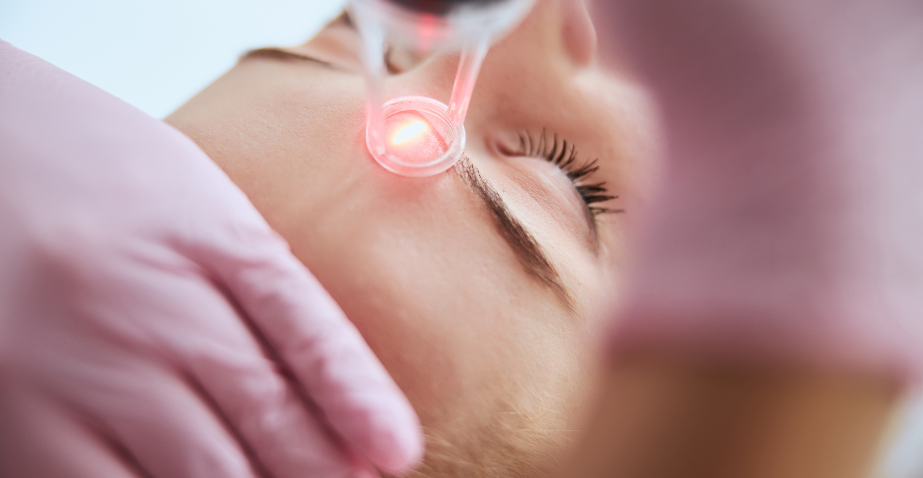 Lasers et LED médecine esthétique
